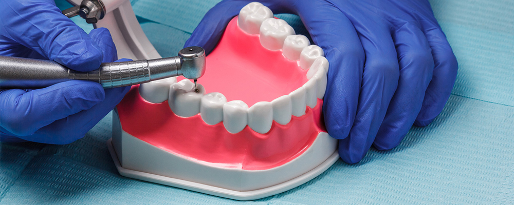 All you need to know about Prosthodontics Treatment in Vijayawada